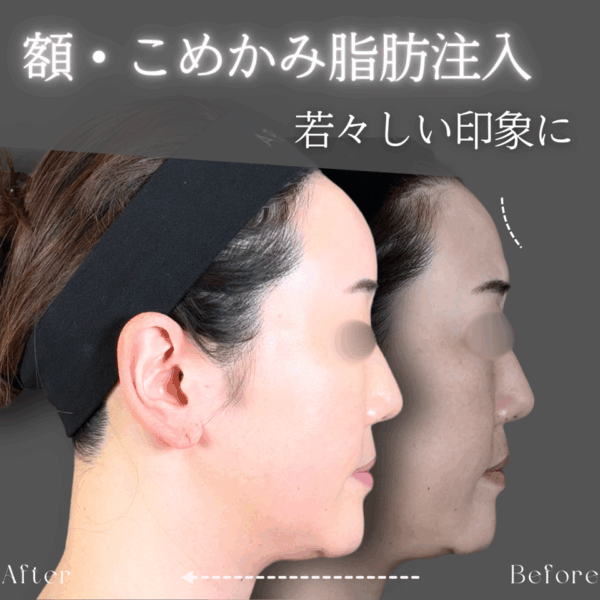 No.8881の症例写真